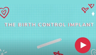 El implante anticonceptivo